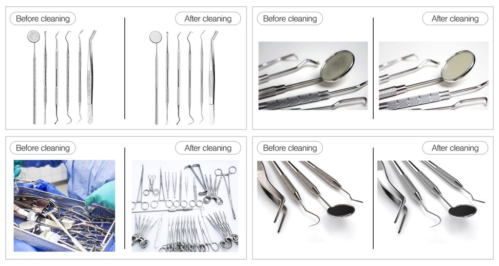 Hiệu quả của rửa dụng cụ nha khoa bằng sóng siêu âm